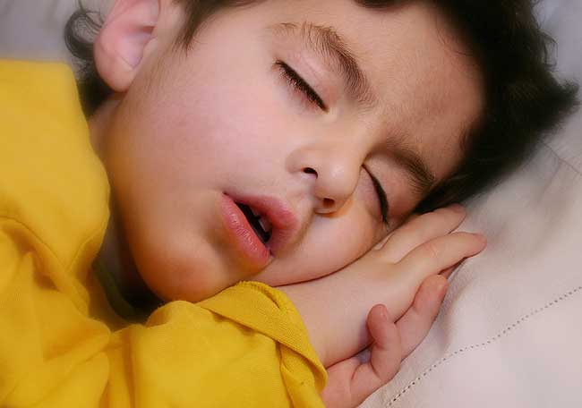 El niño respirador oral